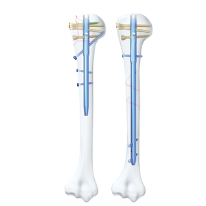 Geasure Orthopedic Titanium Intramedullary Nail Multi-Lock Interlocking Humeral Nail Implants