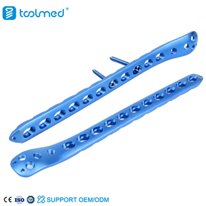Proximal Femoral Locking Plate-I