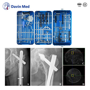 CE ISO13485 PFNA Intramedullary Nail System