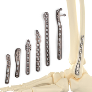 CANWELL 2.7 3.5 Distal Fibula Locking Plate Tibial Bone Titanium