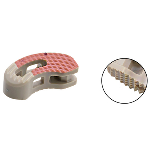Geasure Customizable TLIF T-PAL Spine Implants Orthopedic Lumbar Spine Cage