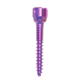 Orthopedic Implants and Instruments Set Polyaxial Spine Titanium Pedicle Screws Upgraded Usmart 5.5 Spinal Screw-Rod System