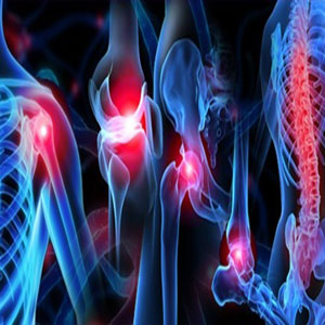 Trauma Implants – Intramedullary Nails, Locking Plates & Screws