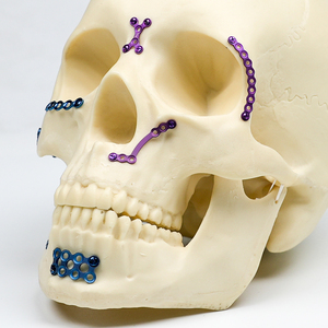 CANWELL CMF Titanium Maxillofacial Plate and Screw System